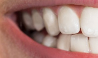 门牙有缝怎么办（前面门牙有缝怎么办）