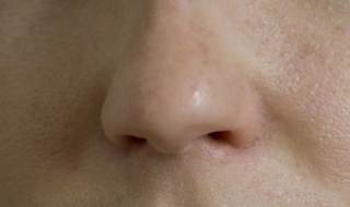 流鼻血怎么办（流鼻血怎么办?）