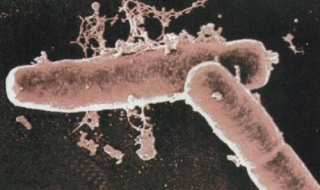 衣原体感染的原因 沙眼衣原体感染的原因