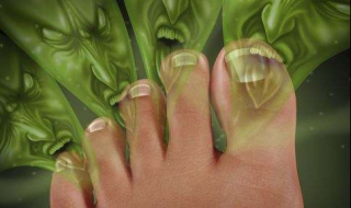 脚气反复发作，怎么才能彻底治疗 脚气反复发作,怎么才能彻底治疗好