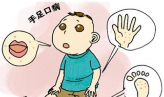 怎样预防手足口病 怎样预防手足口病?