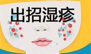 头上长湿疹怎么治（婴儿头上长湿疹怎么治）