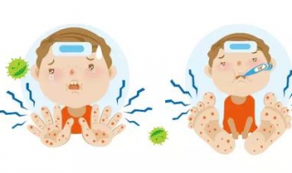 手足口病图片 手足口病图片初期图片