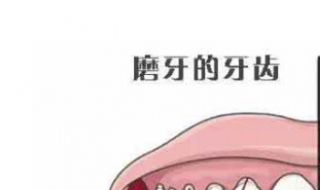 磨牙是什么原因 磨牙是什么原因引起的如何治疗