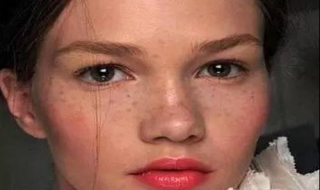 脸上长斑是什么原因 脸上的斑是怎么造成的