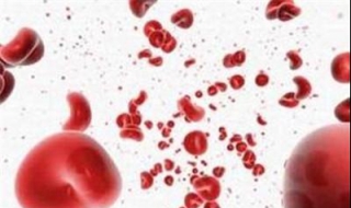 尿血是怎么回事（尿血是怎么回事女性）