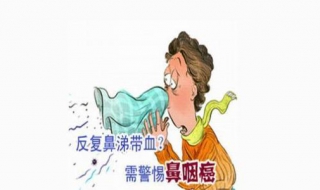 鼻咽癌早期症状表现 鼻咽癌早期症状表现鼻咽癌出血图片