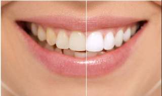 小便黄是什么原因（小便黄是什么原因男性吃什么药）