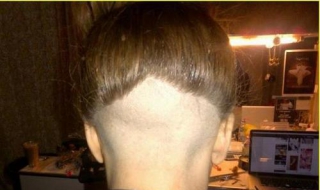 后脑勺疼是怎么回事（后脑勺疼是怎么回事一阵一阵的）