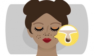 毛孔粗大如何改善（毛孔粗大怎么修复）