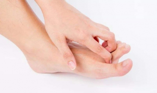 如何治脚气 如何治脚气且除根