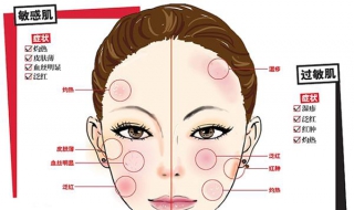 脸上过敏怎么办 请问脸上过敏怎么办