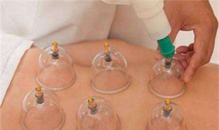 拔罐减肥有效吗（中药拔罐减肥有效吗）