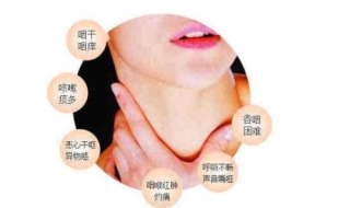 喉咙痒咳嗽怎么办（嗓子很痒一直咳嗽怎么办）