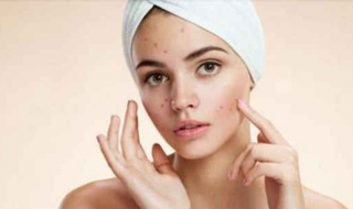 脸上过敏怎么办（冬天脸上过敏怎么办）