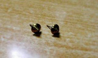 金属过敏怎么办，治疗方法如下 金属过敏怎么办,治疗方法如下