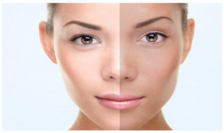 脸部肤色不均怎么办 脸色肤色不均怎么办