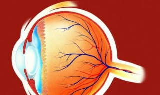 白眼球有黄斑怎么办 白眼球黄斑怎么回事