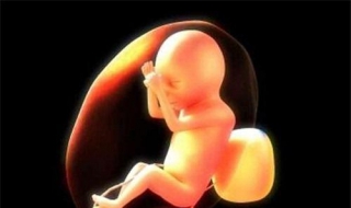 胎儿肾积水怎么办（胎儿肾积水怎么办?）