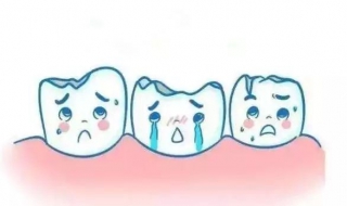 蛀牙疼怎么办（女生蛀牙疼怎么办）