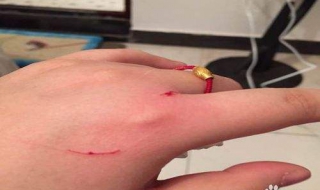 被猫抓伤怎么办（猫眼睛被猫抓伤怎么办）