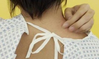 身上很痒怎么办（冬天身上很痒怎么办）