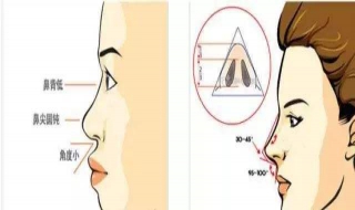 鼻子很塌怎么办 两岁宝宝鼻子很塌怎么办