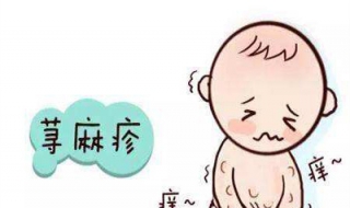 过敏性荨麻疹怎么办（小孩子过敏性荨麻疹怎么办）