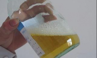 小便黄怎么办 小便黄怎么办女性