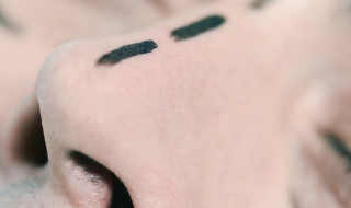 隆鼻失败怎么办 隆鼻失败怎么办?