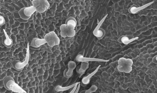 阴囊湿疹怎么办 宝宝阴囊湿疹怎么办