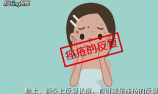 长暗疮怎么办 长暗疮怎么办小妙招