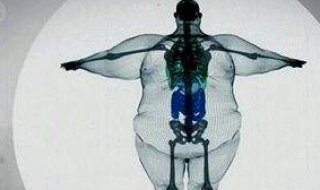 骨架大怎么办（脸的骨架大怎么办）