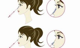 鼻梁歪怎么办（鼻梁歪怎么办图片）