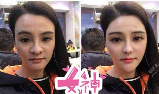 鼻翼宽大怎么办（鼻翼宽大怎么办鼻孔圆怎么办）