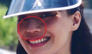 鼻子脱皮怎么办