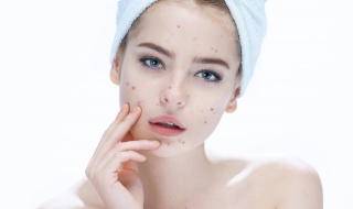 肝火旺长痘怎么办（肝火旺长痘怎么办呢）