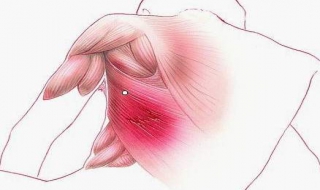 软组织损伤怎么办（脚部软组织损伤怎么办）