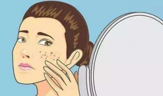 青春痘破了怎么办 青春痘破了怎么办用什么药