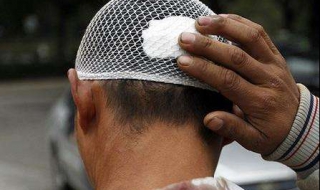 轻微脑震荡怎么办 摔倒轻微脑震荡怎么办