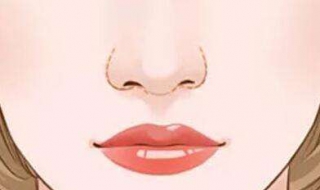 鼻翼宽怎么办（14岁鼻翼宽怎么办）