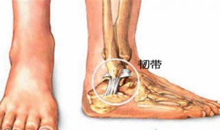 韧带拉伤怎么办（肩膀韧带拉伤怎么办）