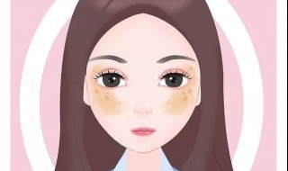 面部黄褐斑怎么办（面部黄褐斑怎么办）