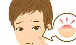 青春痘疤痕怎么办（青春痘怎么处理不留疤）