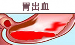 胃出血怎么办（胃出血吃什么食物好养胃）