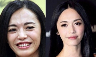 眼角鱼尾纹怎么办 眼角有鱼尾纹是怎么回事