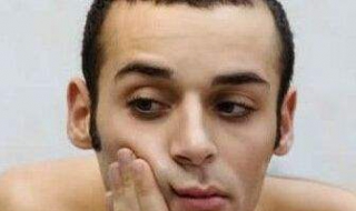 脸部毛孔粗大怎么办 脸部毛孔粗大怎么办改善