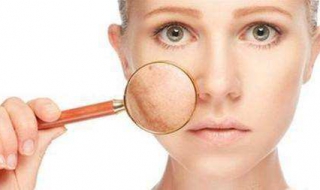 肤色不匀怎么办 皮肤暗沉肤色不均怎么办