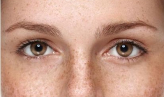 眼角长斑怎么办 眼角长斑怎么办?