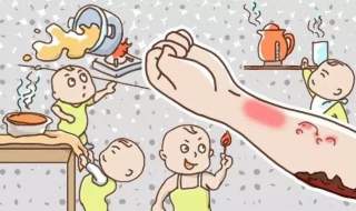 烫伤起泡怎么办（手指烫伤起泡怎么办）